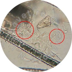 Микроспория у кошки. Рядом с неповрежденными стержнями волос видны споры грибов (обведены красным).